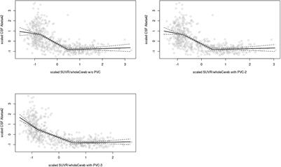 Partial Volume Correction Increases the Sensitivity of 18F-Florbetapir-Positron Emission Tomography for the Detection of Early Stage Amyloidosis